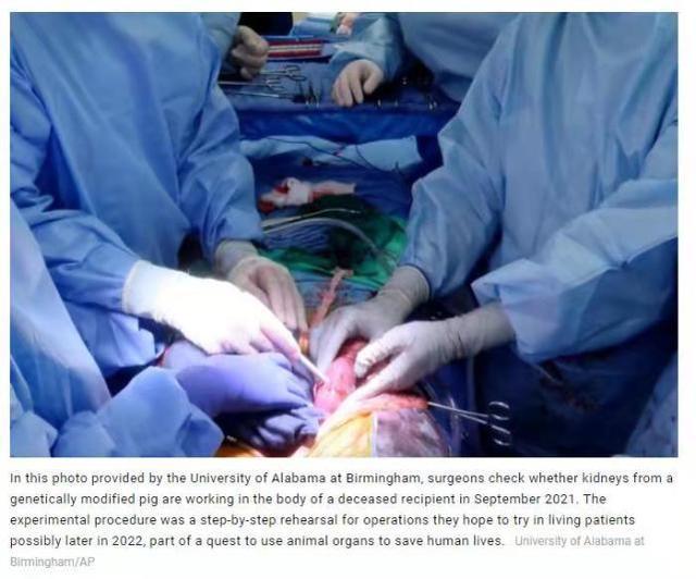 美国阿拉巴马州的外科医生将一只猪的肾脏移植到了一个脑死亡患者身上