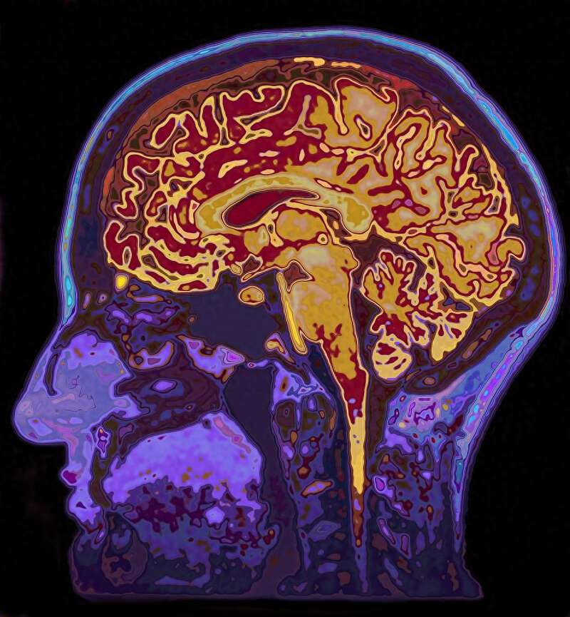 伦敦大学研究人员提出七种延缓大脑衰退方法